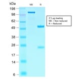 SDS-PAGE - Anti-SOX10 Antibody [SOX10/2311R] (A250019) - Antibodies.com