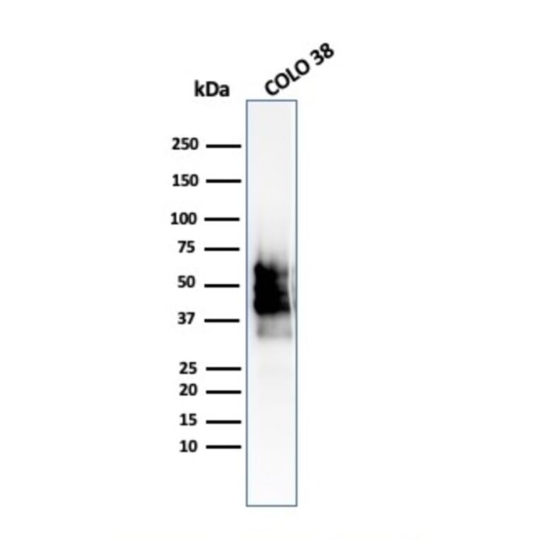 Western Blot - Anti-SOX10 Antibody [SOX10/2311R] (A250019) - Antibodies.com