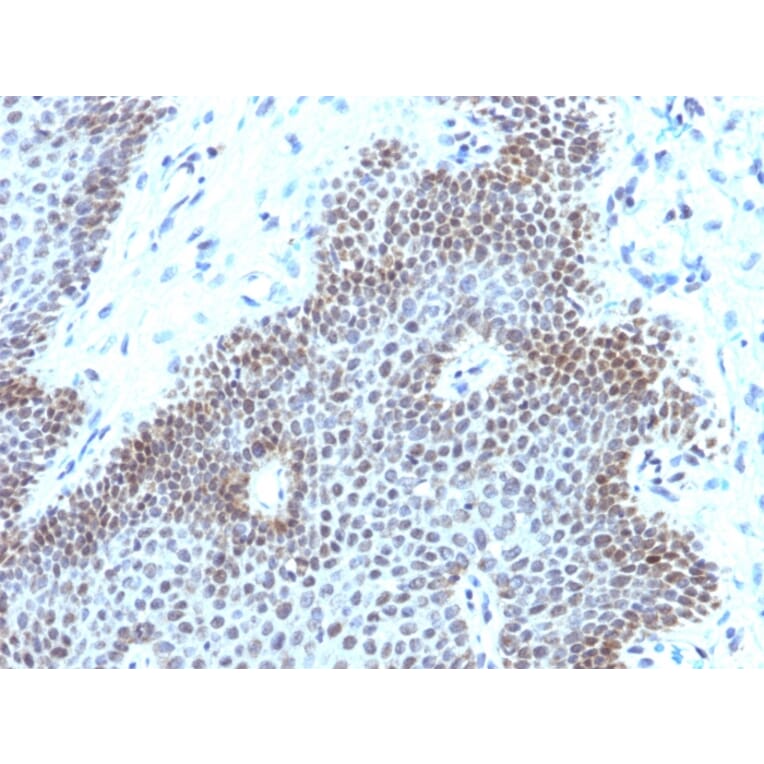 Immunohistochemistry - Anti-SOX11 Antibody [SOX11/3235R] (A250019) - Antibodies.com