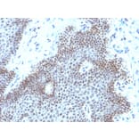 Immunohistochemistry - Anti-SOX11 Antibody [SOX11/3235R] (A250019) - Antibodies.com