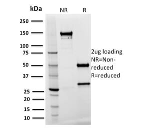 SDS-PAGE - Anti-Spastin Antibody [Sp 3G11-1] (A250020) - Antibodies.com