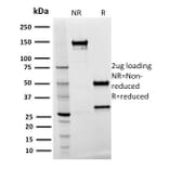 SDS-PAGE - Anti-Spastin Antibody [Sp 3G11-1] (A250020) - Antibodies.com