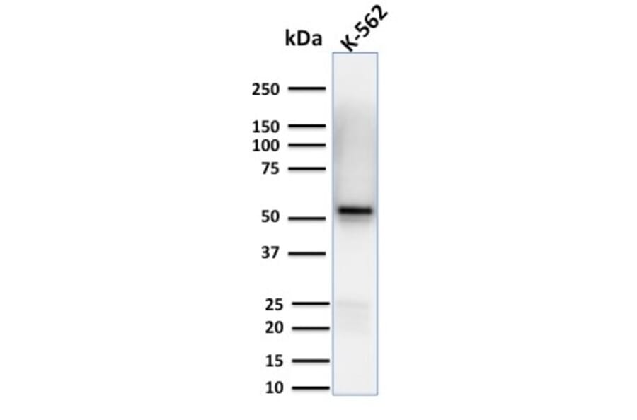 Western Blot - Anti-Spastin Antibody [Sp 6C6] (A250022) - Antibodies.com