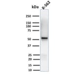 Western Blot - Anti-Spastin Antibody [Sp 6C6] (A250022) - Antibodies.com