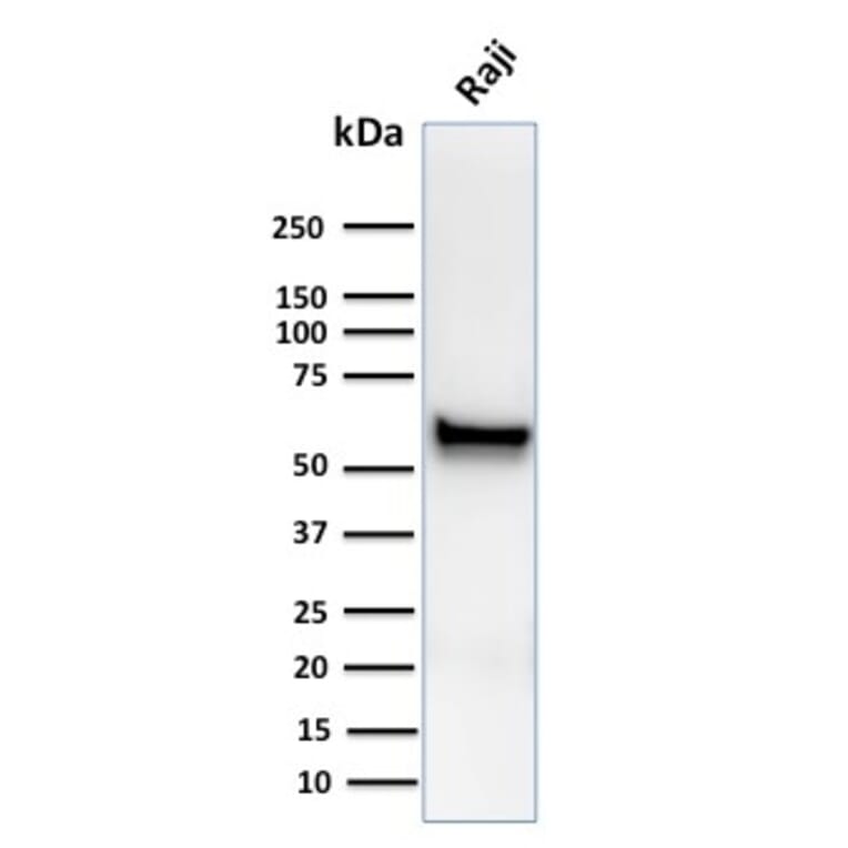 Western Blot - Anti-Spastin Antibody [Sp 6C6] (A250022) - Antibodies.com