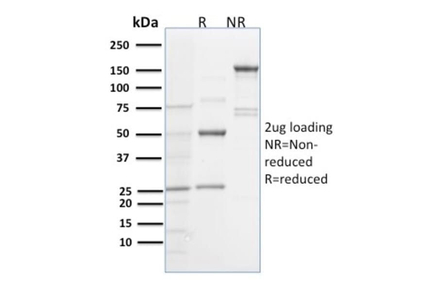 SDS-PAGE - Anti-Spastin Antibody [Sp 6C6] (A250021) - Antibodies.com