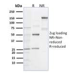 SDS-PAGE - Anti-Spastin Antibody [Sp 6C6] (A250021) - Antibodies.com