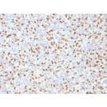 Immunohistochemistry - Anti-PU.1 Antibody [PU1/2146] (A250023) - Antibodies.com
