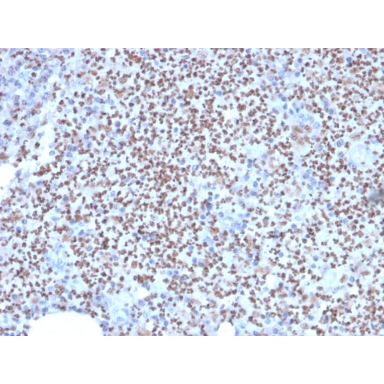 Immunohistochemistry - Anti-PU.1 Antibody [PU1/2146] (A250023) - Antibodies.com