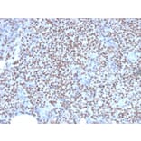 Immunohistochemistry - Anti-PU.1 Antibody [PU1/2146] (A250023) - Antibodies.com