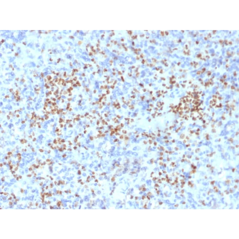 Immunohistochemistry - Anti-PU.1 Antibody [PU1/2146] (A250023) - Antibodies.com