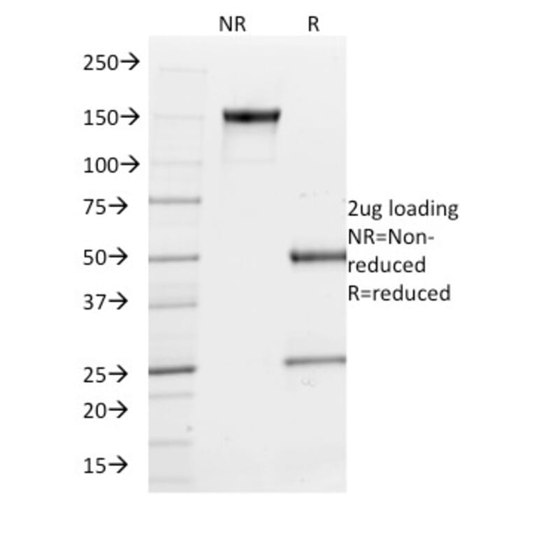 SDS-PAGE - Anti-PU.1 Antibody [PU1/2146] (A250023) - Antibodies.com