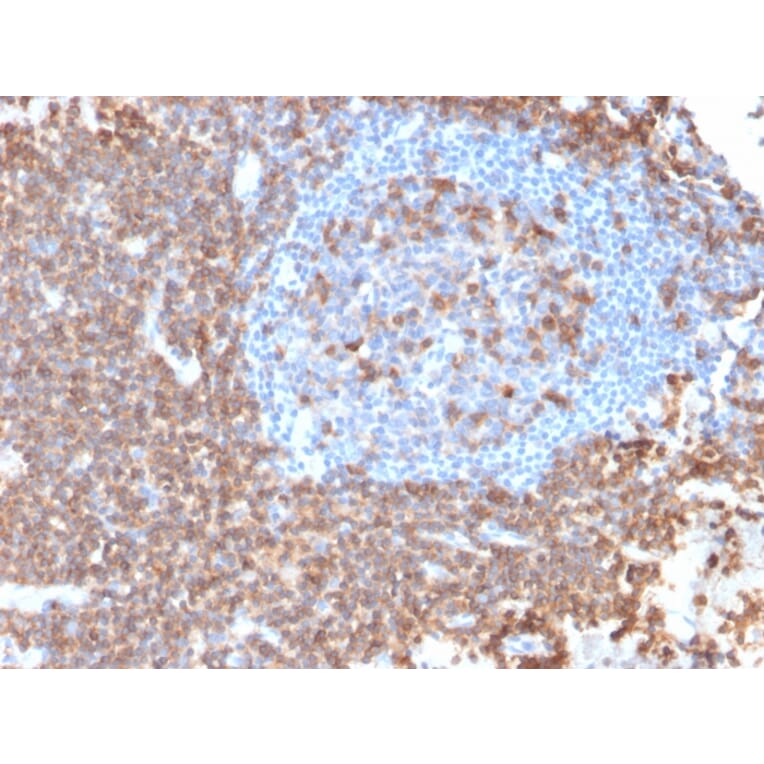 Immunohistochemistry - Anti-CD43 Antibody [rSPN/839] (A250024) - Antibodies.com