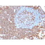 Immunohistochemistry - Anti-CD43 Antibody [rSPN/839] (A250024) - Antibodies.com