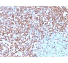 Immunohistochemistry - Anti-CD43 Antibody [SPN/3388] (A250025) - Antibodies.com