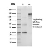 SDS-PAGE - Anti-CD43 Antibody [SPN/3388] (A250025) - Antibodies.com