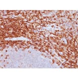 Immunohistochemistry - Anti-CD43 Antibody [DF-T1] (A250026) - Antibodies.com