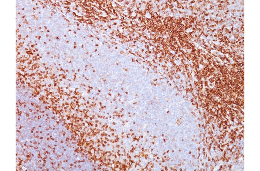 Immunohistochemistry - Anti-CD43 Antibody [SPM503] (A250027) - Antibodies.com