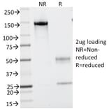 SDS-PAGE - Anti-CD43 Antibody [SPN/839] (A250028) - Antibodies.com