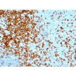 Immunohistochemistry - Anti-CD43 Antibody [84-3C1] (A250029) - Antibodies.com