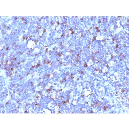 Immunohistochemistry - Anti-CD43 Antibody [SPN/1094] (A250030) - Antibodies.com