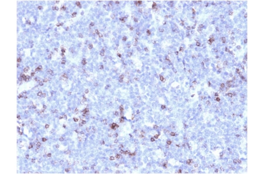 Immunohistochemistry - Anti-CD43 Antibody [rSPN/1094] (A250031) - Antibodies.com