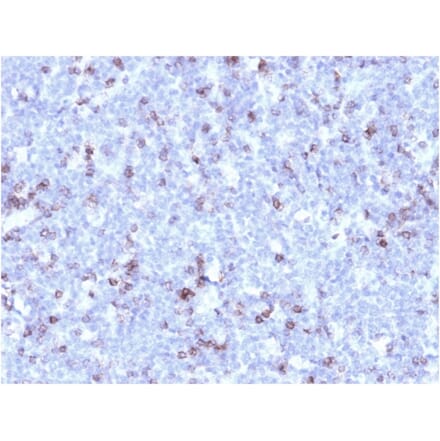 Immunohistochemistry - Anti-CD43 Antibody [rSPN/1094] (A250031) - Antibodies.com