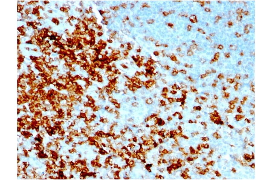 Immunohistochemistry - Anti-CD43 Antibody [rSPN/1094] (A250031) - Antibodies.com