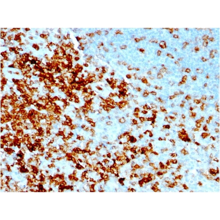 Immunohistochemistry - Anti-CD43 Antibody [rSPN/1094] (A250031) - Antibodies.com