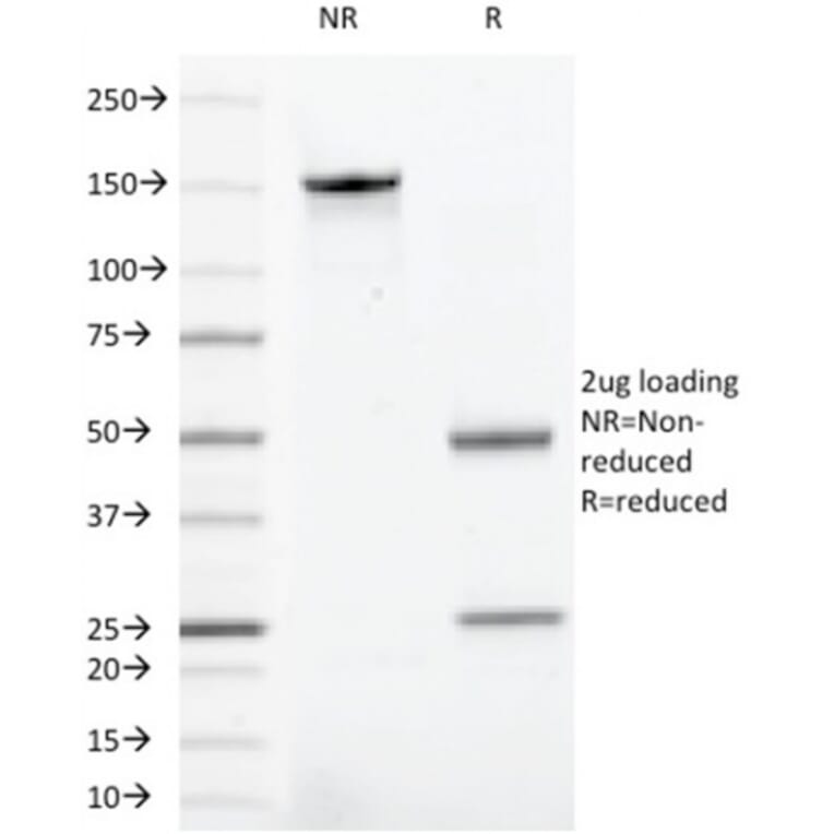 SDS-PAGE - Anti-CD43 Antibody [rSPN/1094] (A250031) - Antibodies.com