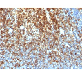 Immunohistochemistry - Anti-CD43 Antibody [SPN/1766R] (A250032) - Antibodies.com