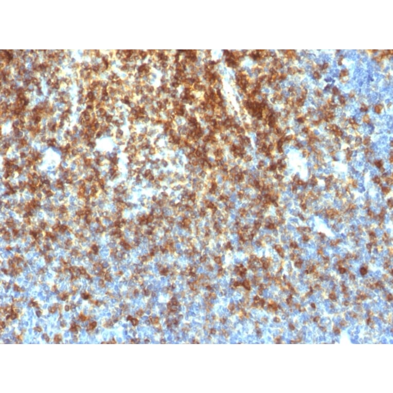 Immunohistochemistry - Anti-CD43 Antibody [SPN/1766R] (A250032) - Antibodies.com