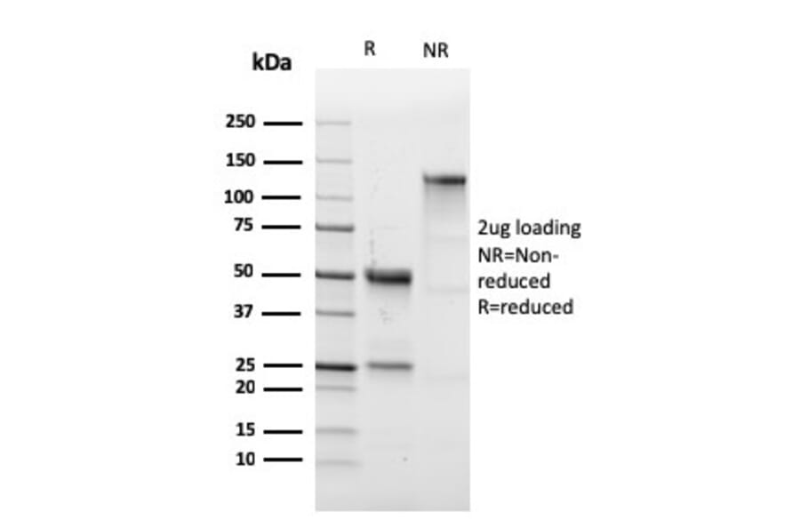 SDS-PAGE - Anti-CD43 Antibody [SPN/1766R] (A250032) - Antibodies.com