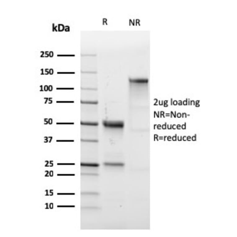 SDS-PAGE - Anti-CD43 Antibody [SPN/1766R] (A250032) - Antibodies.com