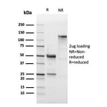 SDS-PAGE - Anti-CD43 Antibody [SPN/1766R] (A250032) - Antibodies.com