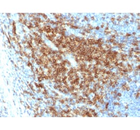 Immunohistochemistry - Anti-CD43 Antibody [SPN/2049R] (A250033) - Antibodies.com