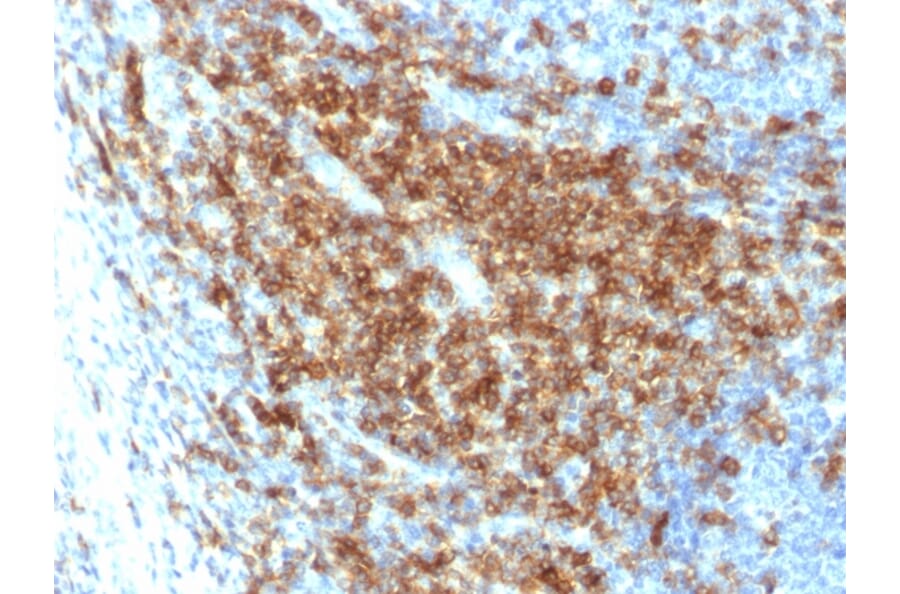 Immunohistochemistry - Anti-CD43 Antibody [SPN/2049R] (A250033) - Antibodies.com