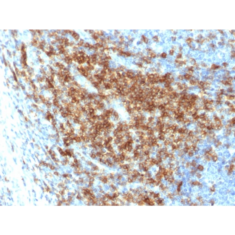 Immunohistochemistry - Anti-CD43 Antibody [SPN/2049R] (A250033) - Antibodies.com