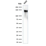 Western Blot - Anti-CD43 Antibody [SPN/2049R] (A250033) - Antibodies.com