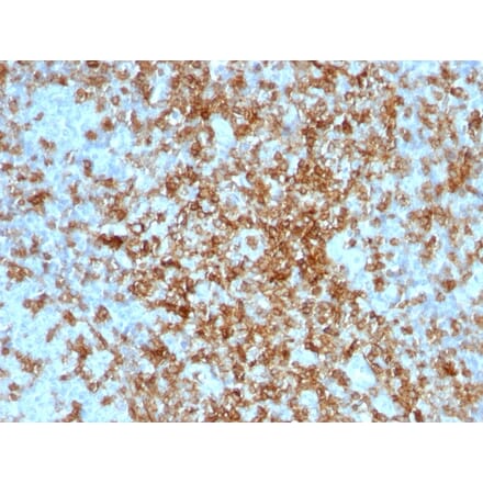 Immunohistochemistry - Anti-CD43 Antibody (A250033) - Antibodies.com
