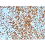 Immunohistochemistry - Anti-CD43 Antibody (A250033) - Antibodies.com