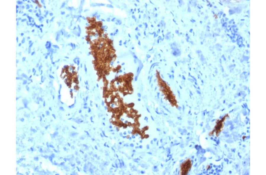 Immunohistochemistry - Anti-alpha 1 Spectrin Antibody [SPTA1/1810] (A250036) - Antibodies.com