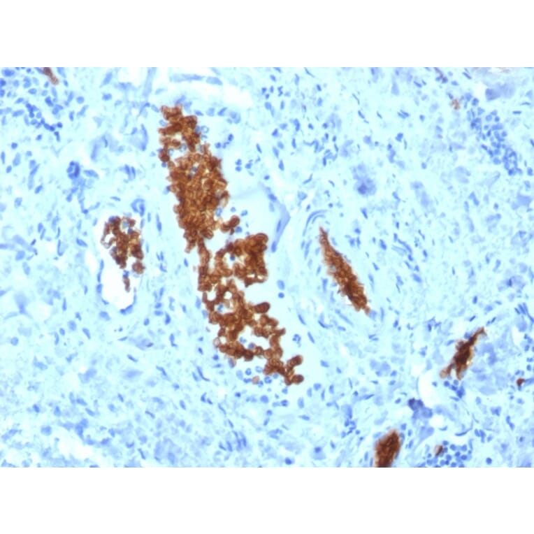 Immunohistochemistry - Anti-alpha 1 Spectrin Antibody [SPTA1/1810] (A250036) - Antibodies.com