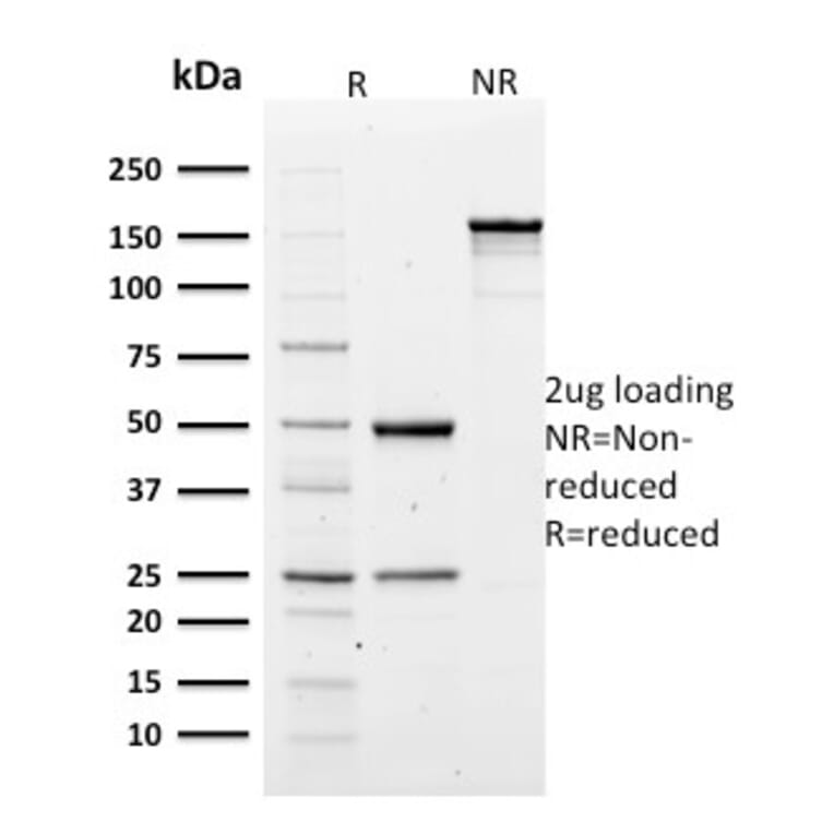 SDS-PAGE - Anti-alpha 1 Spectrin Antibody [SPTA1/1810] (A250036) - Antibodies.com