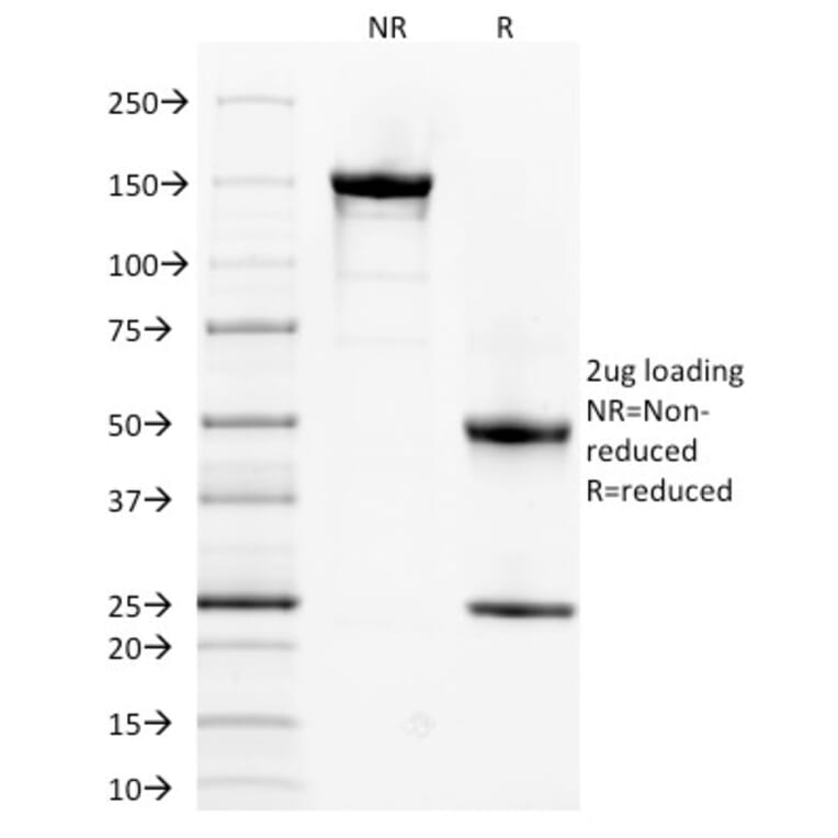 SDS-PAGE - Anti-alpha 1 Spectrin Antibody [SPTA1/1832] (A250037) - Antibodies.com