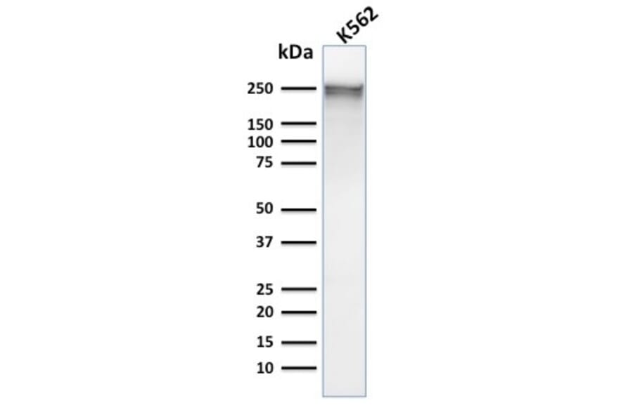 Western Blot - Anti-alpha 1 Spectrin Antibody [SPTA1/1832] (A250037) - Antibodies.com