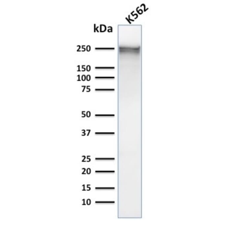 Western Blot - Anti-alpha 1 Spectrin Antibody [SPTA1/1832] (A250037) - Antibodies.com