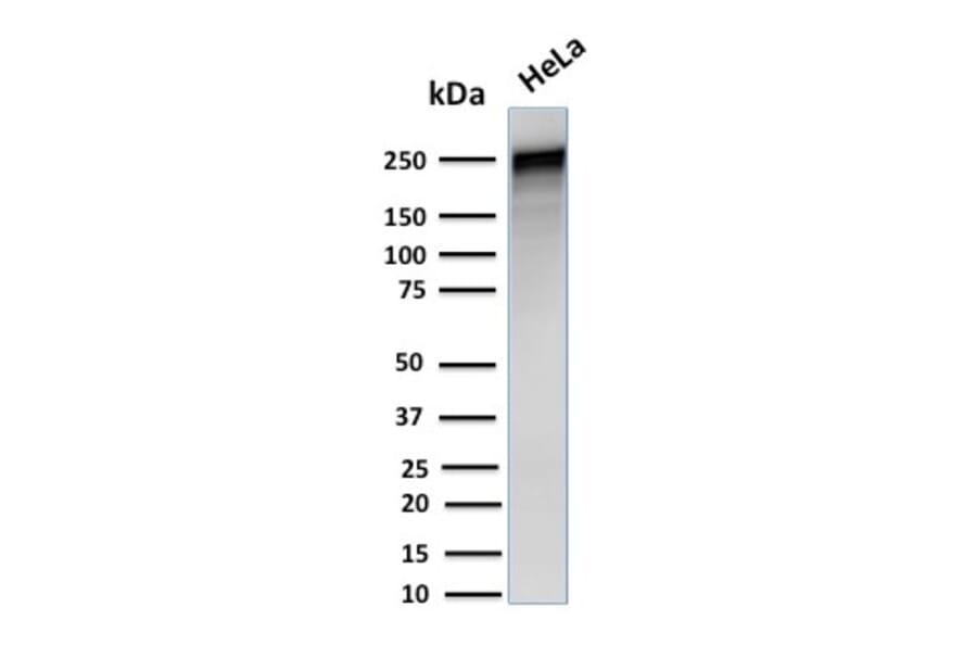 Western Blot - Anti-alpha 1 Spectrin Antibody [SPTA1/1832] (A250037) - Antibodies.com