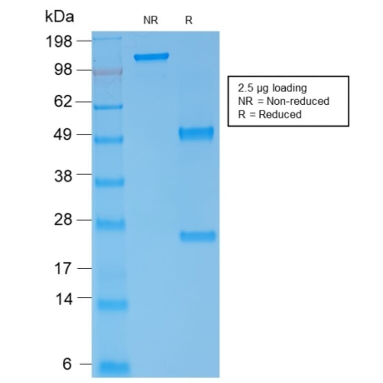 SDS-PAGE - Anti-alpha 1 Spectrin Antibody [rSPTA1/1832] (A250038) - Antibodies.com