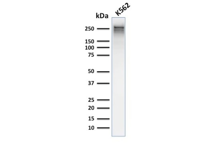Western Blot - Anti-alpha 1 Spectrin Antibody [rSPTA1/1832] (A250038) - Antibodies.com